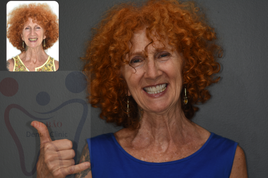 Love the way you smile, Mrs.Susan