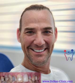 Every time I smile, I can smile naturally – Mr.Justin said